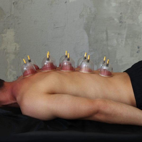 cupping massage Loyaal Thai massage bindweefselmassage cellulitis